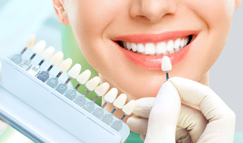 Reason Why Should You Consider Professional Teeth Whitening?