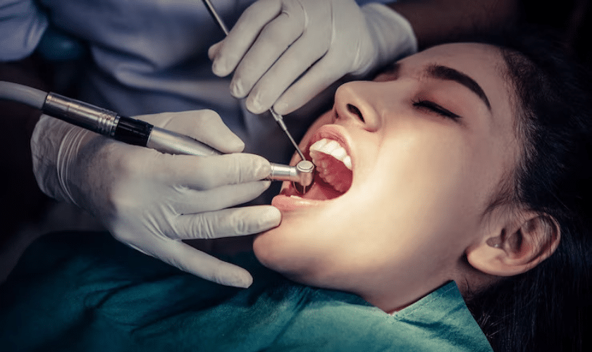 root canal