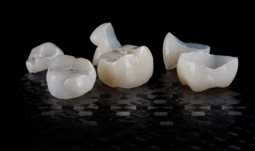 The Benefits of Getting a Crown for Your Damaged Teeth