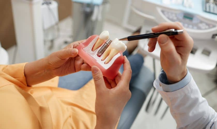 How to Choose the Best Dental Implant Specialist in Shreveport for Your Needs