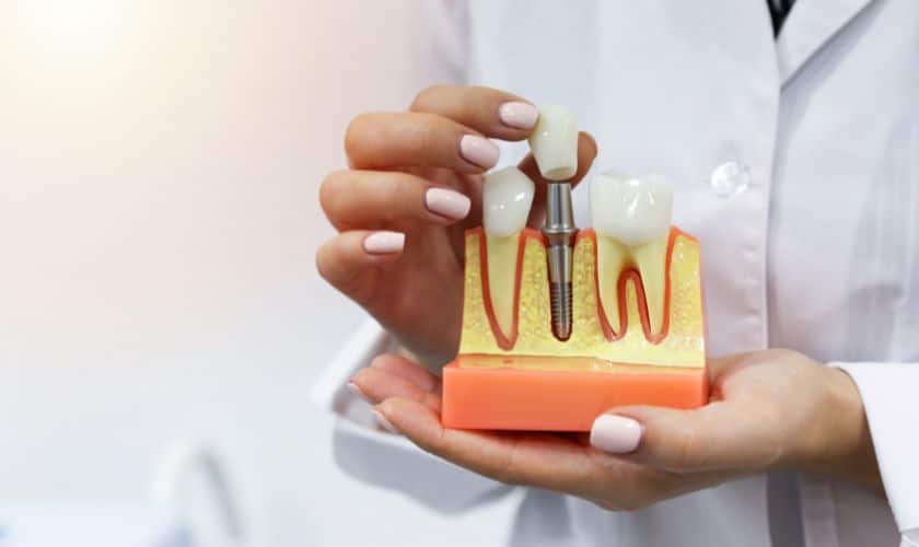 Celebrate Independence Day with a Beautiful Smile: Dental Implants 101