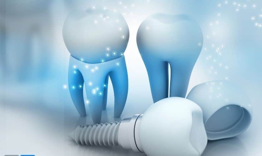 Confidence In Every Bite: Exploring The Benefits Of Dental Implants