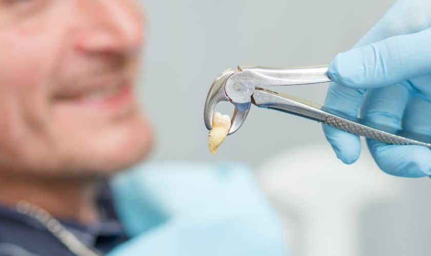 Saying Goodbye to a Troublesome Tooth: A Comprehensive Guide to Tooth Extraction